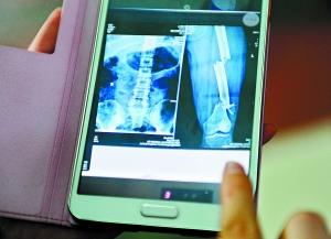 点击进入下一页